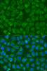 Immunofluorescence analysis of U2OS cells using PIP5K1B antibody (23-154) at dilution of 1:100. Blue: DAPI for nuclear staining.