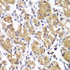 Immunohistochemistry of paraffin-embedded human gastric using DGKE antibody (23-157) at dilution of 1:100 (40x lens) .