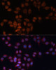 Immunofluorescence analysis of HeLa cells using ADAM15 Polyclonal Antibody (23-160) at dilution of 1:100 (40x lens) . Blue: DAPI for nuclear staining.