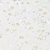 Immunohistochemistry of paraffin-embedded rat brain using SQSTM1 / p62 antibody (23-162) at dilution of 1:100 (40x lens) .