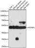 Immunohistochemistry of paraffin-embedded human stomach using PSTPIP1 antibody (23-164) at dilution of 1:100 (40x lens) .