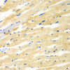 Immunohistochemistry of paraffin-embedded rat heart using PDE4DIP antibody (23-167) at dilution of 1:100 (40x lens) .
