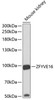 Western blot analysis of extracts of mouse kidney, using ZFYVE16 antibody (23-168) at 1:1000 dilution.<br/>Secondary antibody: HRP Goat Anti-Rabbit IgG (H+L) at 1:10000 dilution.<br/>Lysates/proteins: 25ug per lane.<br/>Blocking buffer: 3% nonfat dry milk in TBST.<br/>Detection: ECL Basic Kit.<br/>Exposure time: 90s.
