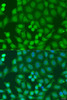 Immunofluorescence analysis of U2OS cells using ZFYVE16 antibody (23-168) at dilution of 1:100. Blue: DAPI for nuclear staining.
