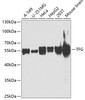 Western blot analysis of extracts of various cell lines, using TFG antibody (23-171) at 1:1000 dilution._Secondary antibody: HRP Goat Anti-Rabbit IgG (H+L) at 1:10000 dilution._Lysates/proteins: 25ug per lane._Blocking buffer: 3% nonfat dry milk in TBST._Detection: ECL Enhanced Kit._Exposure time: 30s.