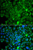 Immunofluorescence analysis of A549 cells using RRAGA antibody (23-172) . Blue: DAPI for nuclear staining.