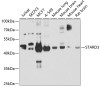 Western blot analysis of extracts of various cell lines, using STARD3 antibody (23-177) at 1:1000 dilution.<br/>Secondary antibody: HRP Goat Anti-Rabbit IgG (H+L) at 1:10000 dilution.<br/>Lysates/proteins: 25ug per lane.<br/>Blocking buffer: 3% nonfat dry milk in TBST.<br/>Detection: ECL Basic Kit.<br/>Exposure time: 15s.