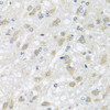 Immunohistochemistry of paraffin-embedded rat brain using HARS2 antibody (23-182) at dilution of 1:100 (40x lens) .