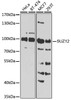 Western blot analysis of extracts of various cell lines, using SUZ12 Antibody (23-183) at 1:1000 dilution.<br/>Secondary antibody: HRP Goat Anti-Rabbit IgG (H+L) at 1:10000 dilution.<br/>Lysates/proteins: 25ug per lane.<br/>Blocking buffer: 3% nonfat dry milk in TBST.<br/>Detection: ECL Basic Kit.<br/>Exposure time: 90s.