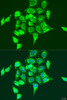 Immunofluorescence analysis of U2OS cells using RASGRP3 antibody (23-186) at dilution of 1:100. Blue: DAPI for nuclear staining.