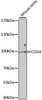 Western blot analysis of extracts of mouse testis, using COG4 antibody (23-187) at 1:1000 dilution.<br/>Secondary antibody: HRP Goat Anti-Rabbit IgG (H+L) at 1:10000 dilution.<br/>Lysates/proteins: 25ug per lane.<br/>Blocking buffer: 3% nonfat dry milk in TBST.<br/>Detection: ECL Basic Kit.<br/>Exposure time: 90s.