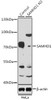 Western blot analysis of extracts from normal (control) and SAMHD1 knockout (KO) HeLa cells, using SAMHD1 antibody (23-189) at 1:1000 dilution.<br/>Secondary antibody: HRP Goat Anti-Rabbit IgG (H+L) at 1:10000 dilution.<br/>Lysates/proteins: 25ug per lane.<br/>Blocking buffer: 3% nonfat dry milk in TBST.<br/>Detection: ECL Basic Kit.<br/>Exposure time: 3min.