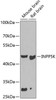 Western blot analysis of extracts of various cell lines, using INPP5K antibody (23-196) at 1:1000 dilution.<br/>Secondary antibody: HRP Goat Anti-Rabbit IgG (H+L) at 1:10000 dilution.<br/>Lysates/proteins: 25ug per lane.<br/>Blocking buffer: 3% nonfat dry milk in TBST.<br/>Detection: ECL Basic Kit.<br/>Exposure time: 90s.