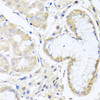 Immunohistochemistry of paraffin-embedded human stomach using INPP5K antibody (23-196) at dilution of 1:100 (40x lens) .