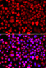 Immunofluorescence analysis of A549 cells using ALG1 antibody (23-205) . Blue: DAPI for nuclear staining.