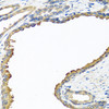 Immunohistochemistry of paraffin-embedded human prostate using NYX antibody (23-212) at dilution of 1:100 (40x lens) .