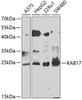 Western blot analysis of extracts of various cell lines, using RAB17 antibody (23-213) at 1:1000 dilution.<br/>Secondary antibody: HRP Goat Anti-Rabbit IgG (H+L) at 1:10000 dilution.<br/>Lysates/proteins: 25ug per lane.<br/>Blocking buffer: 3% nonfat dry milk in TBST.<br/>Detection: ECL Basic Kit.<br/>Exposure time: 90s.