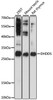 Western blot analysis of extracts of various cell lines, using DHDDS antibody (23-216) at 1:1000 dilution.<br/>Secondary antibody: HRP Goat Anti-Rabbit IgG (H+L) at 1:10000 dilution.<br/>Lysates/proteins: 25ug per lane.<br/>Blocking buffer: 3% nonfat dry milk in TBST.<br/>Detection: ECL Basic Kit.<br/>Exposure time: 20s.