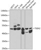 Western blot analysis of extracts of various cell lines, using TSEN2 antibody (23-218) at 1:1000 dilution.<br/>Secondary antibody: HRP Goat Anti-Rabbit IgG (H+L) at 1:10000 dilution.<br/>Lysates/proteins: 25ug per lane.<br/>Blocking buffer: 3% nonfat dry milk in TBST.<br/>Detection: ECL Basic Kit.<br/>Exposure time: 90s.