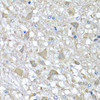 Immunohistochemistry of paraffin-embedded rat brain using VPS37A antibody (23-230) at dilution of 1:100 (40x lens) .