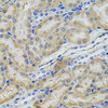 Immunohistochemistry of paraffin-embedded rat kidney using PCSK9 antibody (23-233) at dilution of 1:100 (40x lens) .