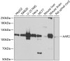 Western blot analysis of extracts of various cell lines, using AARS antibody (23-235) at 1:1000 dilution.<br/>Secondary antibody: HRP Goat Anti-Rabbit IgG (H+L) at 1:10000 dilution.<br/>Lysates/proteins: 25ug per lane.<br/>Blocking buffer: 3% nonfat dry milk in TBST.<br/>Detection: ECL Basic Kit.<br/>Exposure time: 90s.