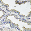 Immunohistochemistry of paraffin-embedded human prostate using ACO1 antibody (23-238) at dilution of 1:100 (40x lens) .