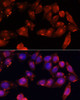 Immunofluorescence analysis of HeLa cells using ACVR2B antibody (23-239) at dilution of 1:100 (40x lens) . Blue: DAPI for nuclear staining.