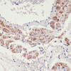 Immunohistochemistry of paraffin-embedded rat lung using ADRA1A antibody (23-244) at dilution of 1:100 (40x lens) .