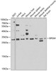 Western blot analysis of extracts of various cell lines, using BPGM antibody (23-250) at 1:1000 dilution.<br/>Secondary antibody: HRP Goat Anti-Rabbit IgG (H+L) at 1:10000 dilution.<br/>Lysates/proteins: 25ug per lane.<br/>Blocking buffer: 3% nonfat dry milk in TBST.<br/>Detection: ECL Basic Kit.<br/>Exposure time: 30s.