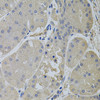 Immunohistochemistry of paraffin-embedded human stomach using CLTC antibody (23-255) (40x lens) .