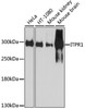 Western blot analysis of extracts of various cell lines, using ITPR1 antibody (23-269) at 1:1000 dilution.<br/>Secondary antibody: HRP Goat Anti-Rabbit IgG (H+L) at 1:10000 dilution.<br/>Lysates/proteins: 25ug per lane.<br/>Blocking buffer: 3% nonfat dry milk in TBST.<br/>Detection: ECL Basic Kit.<br/>Exposure time: 90s.