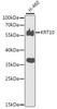 Western blot analysis of extracts of H-460 cells, using KRT10 antibody (23-272) at 1:500 dilution.<br/>Secondary antibody: HRP Goat Anti-Rabbit IgG (H+L) at 1:10000 dilution.<br/>Lysates/proteins: 25ug per lane.<br/>Blocking buffer: 3% nonfat dry milk in TBST.<br/>Detection: ECL Basic Kit.<br/>Exposure time: 90s.
