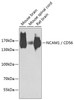 Western blot analysis of extracts of various cell lines, using NCAM1 / CD56 antibody (23-276) at 1:1000 dilution.<br/>Secondary antibody: HRP Goat Anti-Rabbit IgG (H+L) at 1:10000 dilution.<br/>Lysates/proteins: 25ug per lane.<br/>Blocking buffer: 3% nonfat dry milk in TBST.<br/>Detection: ECL Basic Kit.<br/>Exposure time: 90s.