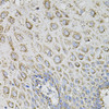 Immunohistochemistry of paraffin-embedded human esophagus using SPR antibody (23-285) (40x lens) .