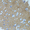 Immunohistochemistry of paraffin-embedded rat brain using STX1A antibody (23-287) (40x lens) .