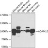 Western blot analysis of extracts of various cell lines, using ADAM12 antibody (23-294) at 1:1000 dilution.<br/>Secondary antibody: HRP Goat Anti-Rabbit IgG (H+L) at 1:10000 dilution.<br/>Lysates/proteins: 25ug per lane.<br/>Blocking buffer: 3% nonfat dry milk in TBST.<br/>Detection: ECL Basic Kit.<br/>Exposure time: 90s.