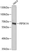 Western blot analysis of extracts of HeLa cells, using PIP5K1A antibody (23-295) at 1:1000 dilution.<br/>Secondary antibody: HRP Goat Anti-Rabbit IgG (H+L) at 1:10000 dilution.<br/>Lysates/proteins: 25ug per lane.<br/>Blocking buffer: 3% nonfat dry milk in TBST.<br/>Detection: ECL Basic Kit.<br/>Exposure time: 90s.