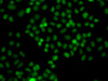 Immunofluorescence analysis of A549 cells using PIP5K1A antibody (23-295) .