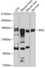 Western blot analysis of extracts of various cell lines, using IRS2 antibody (23-299) at 1:1000 dilution.<br/>Secondary antibody: HRP Goat Anti-Rabbit IgG (H+L) at 1:10000 dilution.<br/>Lysates/proteins: 25ug per lane.<br/>Blocking buffer: 3% nonfat dry milk in TBST.<br/>Detection: ECL Basic Kit.<br/>Exposure time: 60s.