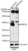 Western blot analysis of extracts from normal (control) and ERP29 knockout (KO) 293T cells, using ERP29 antibody (23-310) at 1:1000 dilution.<br/>Secondary antibody: HRP Goat Anti-Rabbit IgG (H+L) at 1:10000 dilution.<br/>Lysates/proteins: 25ug per lane.<br/>Blocking buffer: 3% nonfat dry milk in TBST.<br/>Detection: ECL Basic Kit.<br/>Exposure time: 5s.