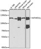 Western blot analysis of extracts of various cell lines, using MTHFD1L antibody (23-317) at 1:1000 dilution.<br/>Secondary antibody: HRP Goat Anti-Rabbit IgG (H+L) at 1:10000 dilution.<br/>Lysates/proteins: 25ug per lane.<br/>Blocking buffer: 3% nonfat dry milk in TBST.<br/>Detection: ECL Basic Kit.<br/>Exposure time: 90s.