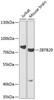 Western blot analysis of extracts of various cell lines, using ZBTB20 antibody (23-318) at 1:1000 dilution.<br/>Secondary antibody: HRP Goat Anti-Rabbit IgG (H+L) at 1:10000 dilution.<br/>Lysates/proteins: 25ug per lane.<br/>Blocking buffer: 3% nonfat dry milk in TBST.<br/>Detection: ECL Basic Kit.<br/>Exposure time: 90s.