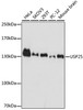 Immunohistochemistry of paraffin-embedded mouse heart using USP25 antibody (23-321) at dilution of 1:100 (40x lens) .