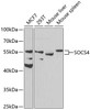 Western blot analysis of extracts of various cell lines, using SOCS4 antibody (23-343) at 1:1000 dilution.<br/>Secondary antibody: HRP Goat Anti-Rabbit IgG (H+L) at 1:10000 dilution.<br/>Lysates/proteins: 25ug per lane.<br/>Blocking buffer: 3% nonfat dry milk in TBST.<br/>Detection: ECL Basic Kit.<br/>Exposure time: 90s.