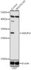 Western blot analysis of extracts from normal (control) and NDUFS3 knockout (KO) 293T cells, using NDUFS3 antibody (23-351) at 1:1000 dilution.<br/>Secondary antibody: HRP Goat Anti-Rabbit IgG (H+L) at 1:10000 dilution.<br/>Lysates/proteins: 25ug per lane.<br/>Blocking buffer: 3% nonfat dry milk in TBST.<br/>Detection: ECL Basic Kit.<br/>Exposure time: 10s.