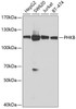 Western blot analysis of extracts of various cell lines, using PHKB antibody (23-353) at 1:1000 dilution.<br/>Secondary antibody: HRP Goat Anti-Rabbit IgG (H+L) at 1:10000 dilution.<br/>Lysates/proteins: 25ug per lane.<br/>Blocking buffer: 3% nonfat dry milk in TBST.<br/>Detection: ECL Basic Kit.<br/>Exposure time: 5s.