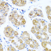 Immunohistochemistry of paraffin-embedded human stomach using PIP4K2B antibody (23-354) at dilution of 1:100 (40x lens) .