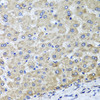 Immunohistochemistry of paraffin-embedded human liver damage using OSGEPL1 antibody (23-357) at dilution of 1:100 (40x lens) .