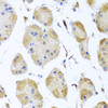 Immunohistochemistry of paraffin-embedded human stomach using MYLK antibody (23-364) at dilution of 1:100 (40x lens) .